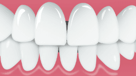 CC_MidlineShift_Tile7